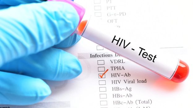 Điều Trị HIV Như Thế Nào Đúng Cách