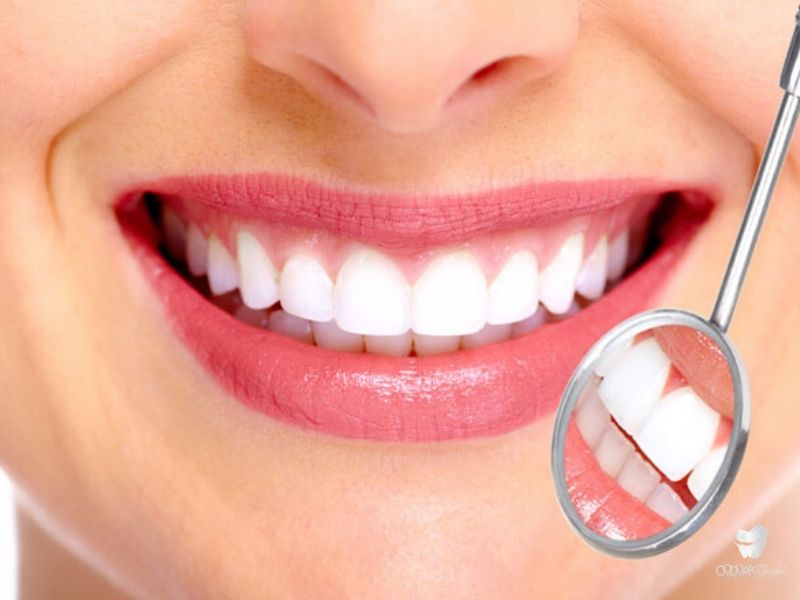 [Nha khoa TP HCM] Các phương pháp tẩy trắng răng hiện nay
