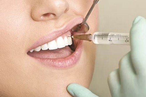 Cấy ghép Implant – Giải pháp làm răng giả tốt nhất cho người già