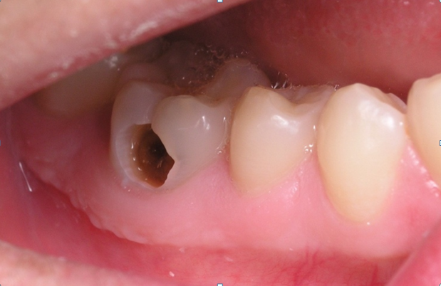Nha khoa quận 10 | Các loại bệnh lí răng miệng thường gặp ở người già
