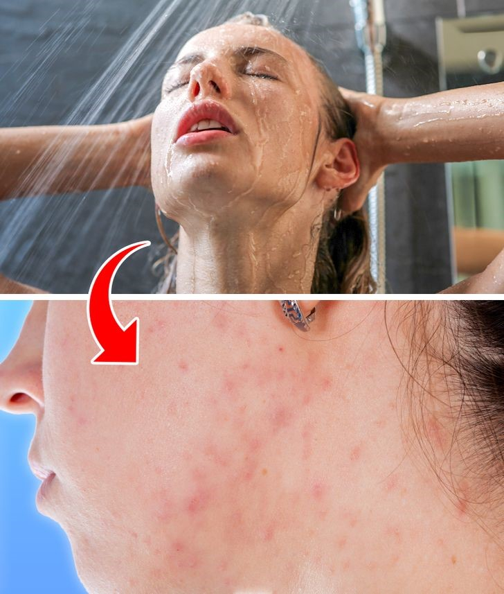Top 5 Tác hại của việc rửa mặt bằng vòi hoa sen khi tắm