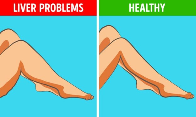 Top 6 Dấu hiệu ở chân có thể cảnh báo về tình hình sức khỏe của bạn