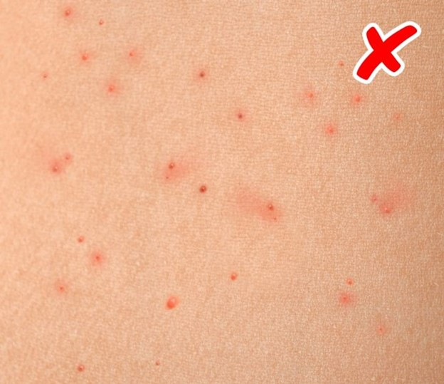 Top 8 Bệnh nghiêm trọng được báo hiệu trên làn da của chúng ta