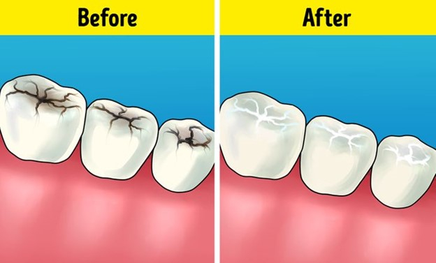 Top 8 Câu hỏi phổ biến nhất về chăm sóc răng miệng mà các nha sĩ thường nhận được