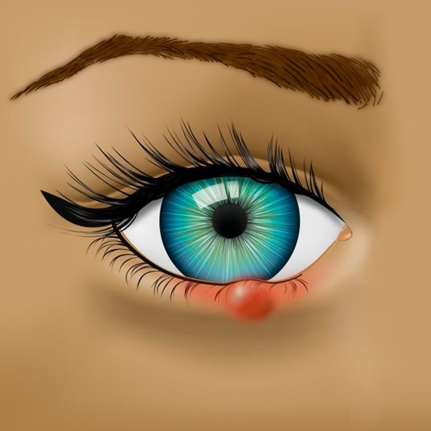 Top 7 Vấn đề về sức khỏe mà đôi mắt đang báo hiệu