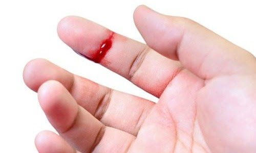 Đứt tay chảy máu: Luận giải điềm báo tốt xấu và con số may mắn