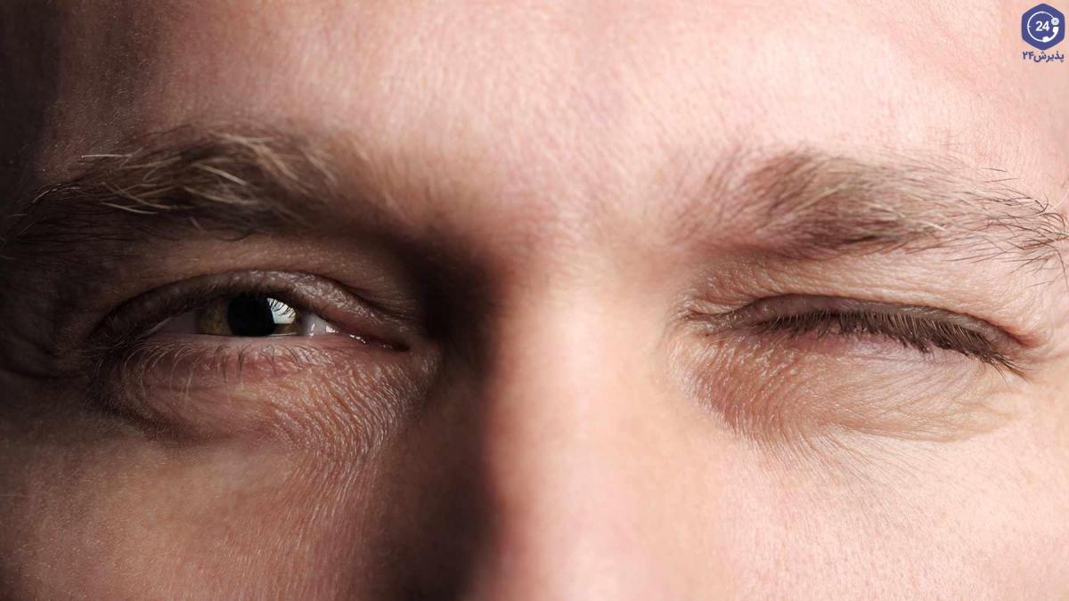 Điềm báo nháy mắt trái nam nữ báo hiệu điều gì?