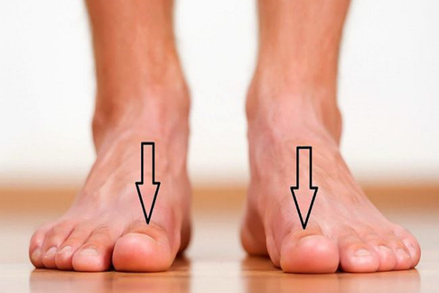 Nốt ruồi ở ngón chân cái đàn ông, phụ nữ có ý nghĩa gì?
